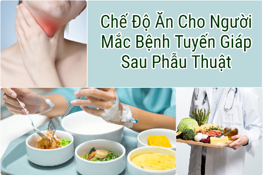 Chế độ ăn ngay sau phẫu thuật tuyến giáp hiệu quả dành cho bệnh nhân